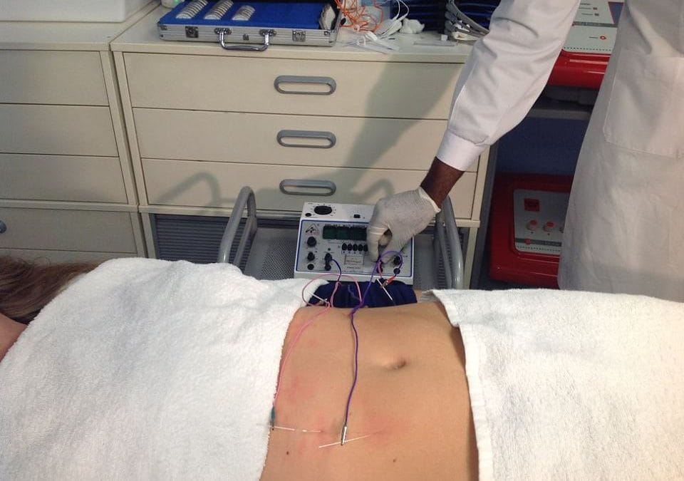 Electroacupuntura Estética (Reducción de grasa localizada)